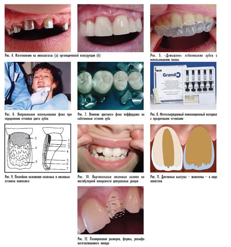индикаторы модернизации по стоматологии